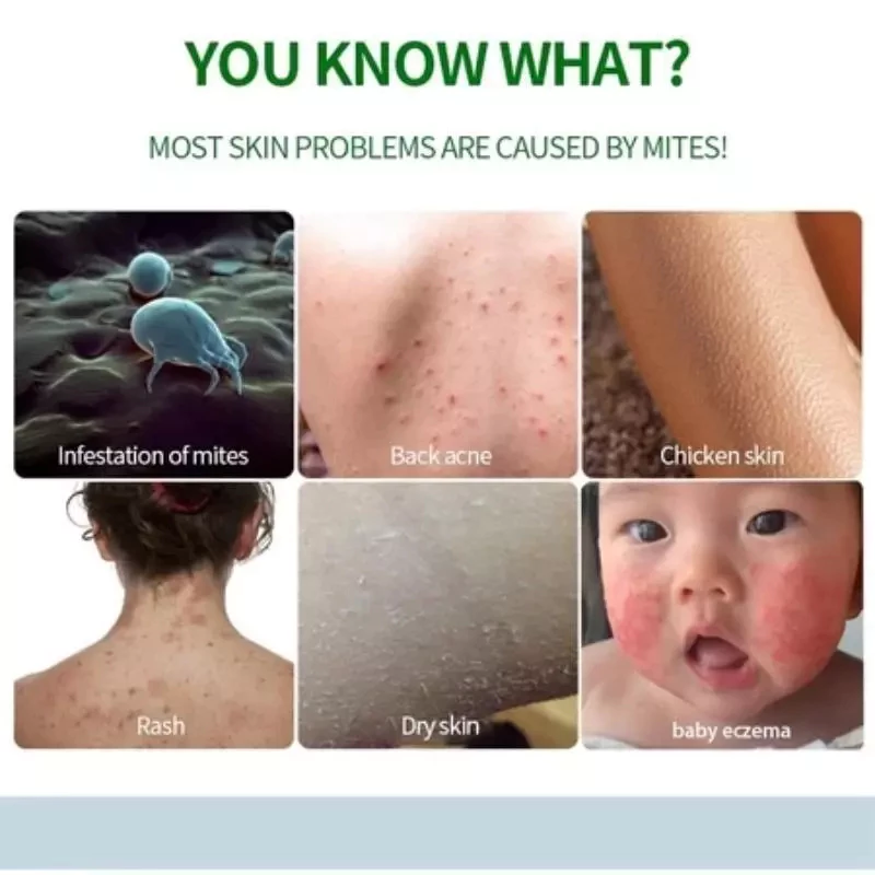 Wormwood Anti-Acne body wash Anti Bacterial Wash Shower Gel Body Wash Relieve itching Lasting Deep Clean 500ML