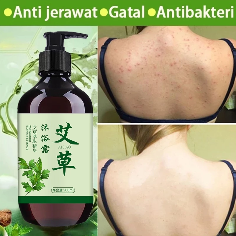 Wormwood Anti-Acne body wash Anti Bacterial Wash Shower Gel Body Wash Relieve itching Lasting Deep Clean 500ML