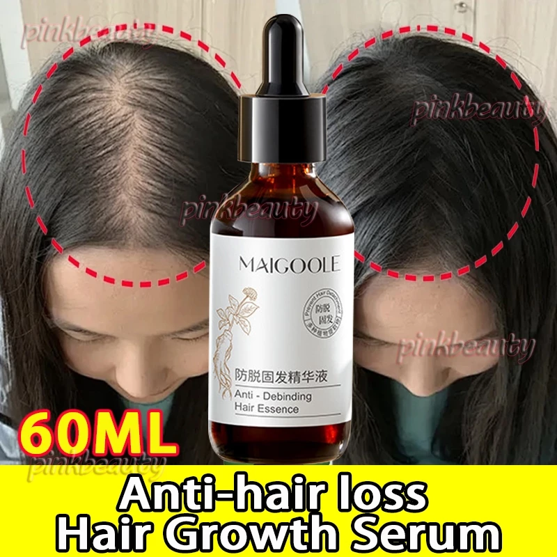 Hair Growth Serum Anti-hair Loss Ginseng Hair Tonic 60ML Ginger Nourishes Scalp Strengthen Hair Roots Reduce Hair Loss