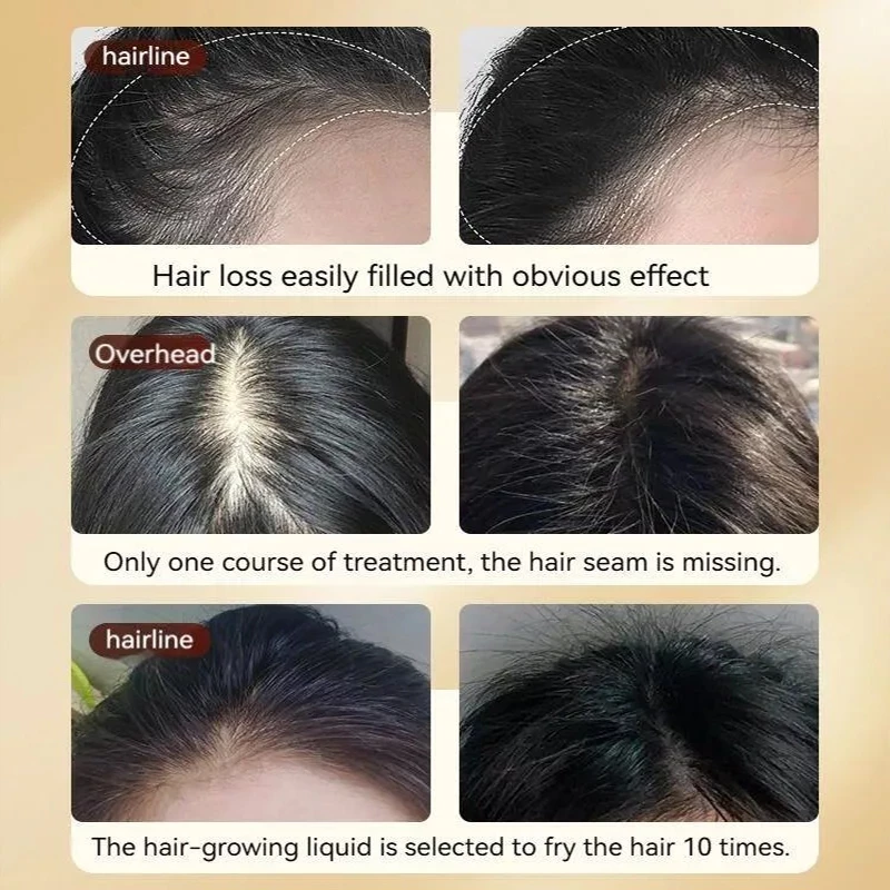 Hair Growth Serum Anti-hair Loss Ginseng Hair Tonic 60ML Ginger Nourishes Scalp Strengthen Hair Roots Reduce Hair Loss