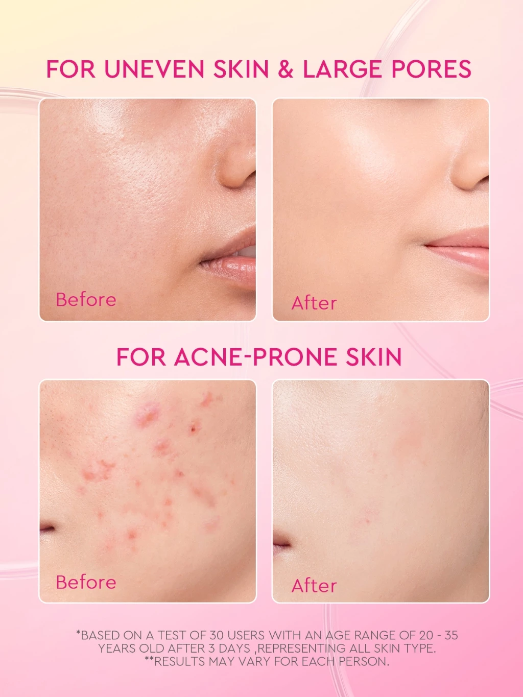 Glad2Glow Peach Retinol Moisturizer Smooth Acne Scar Prone Skin Day Night Face Cream Anti Aging Fine Lines Skincare