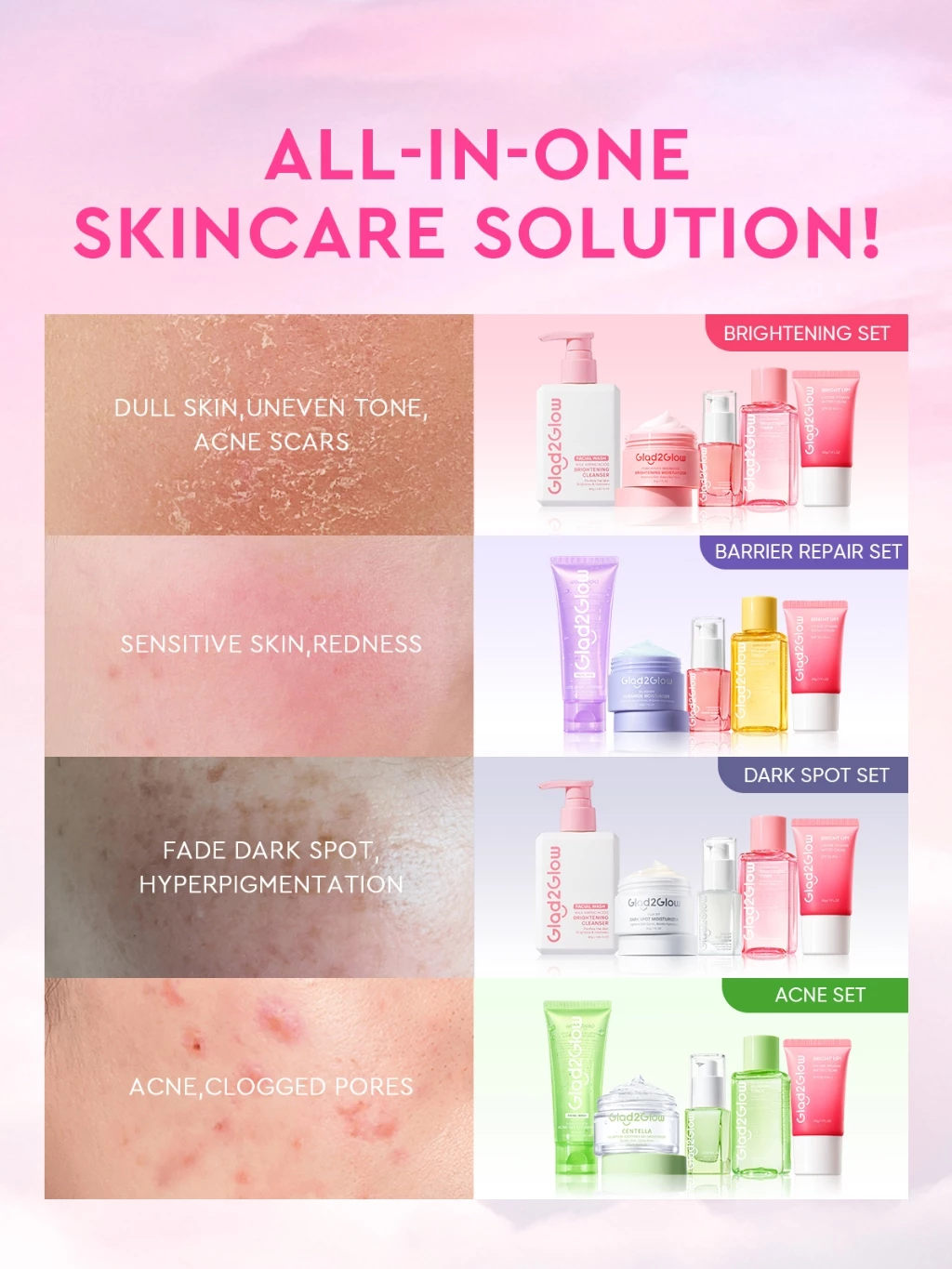 Glad2Glow 5PCS Skincare Set Moisturizer,Sunscreen,Cleanser,Serum,Toner