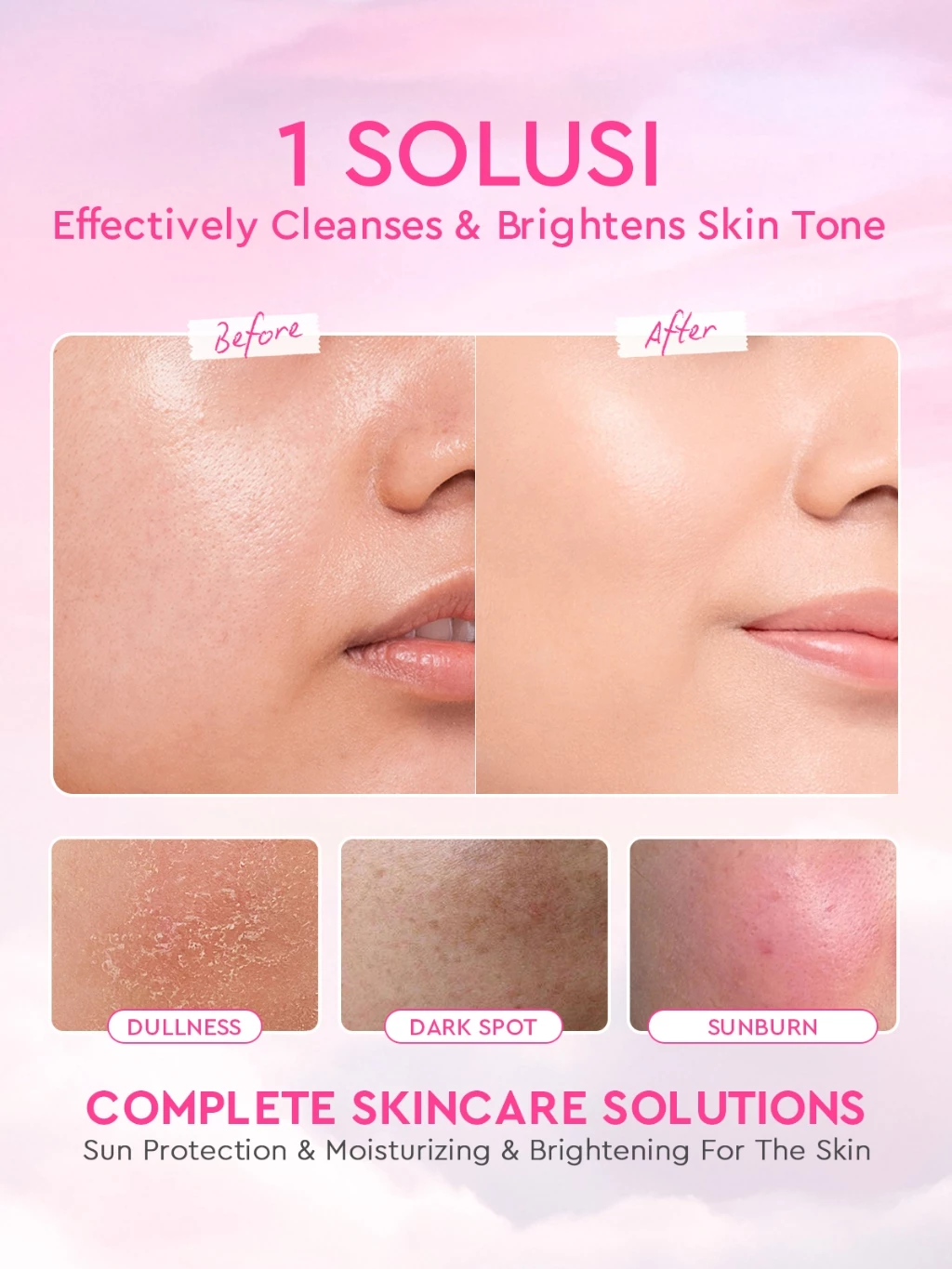 Glad2Glow 5PCS Skincare Set Moisturizer,Sunscreen,Cleanser,Serum,Toner