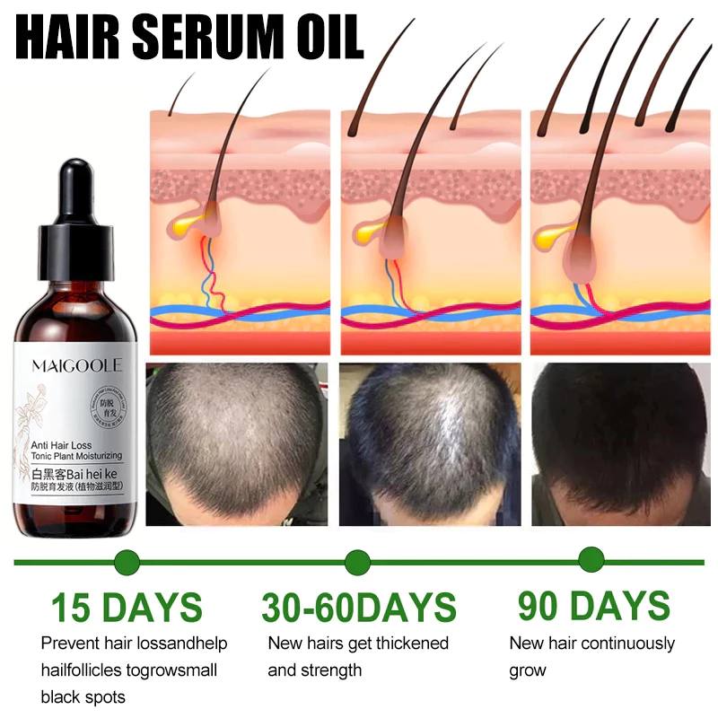 Hair Growth Serum Anti-hair Loss Ginseng Hair Tonic 60ML Ginger Nourishes Scalp Strengthen Hair Roots Reduce Hair Loss
