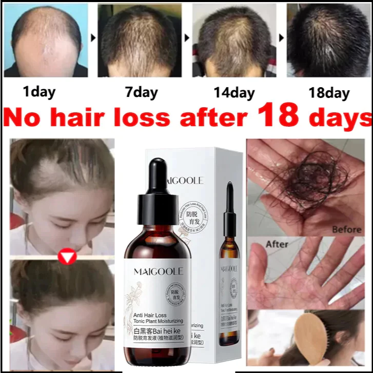 Hair Growth Serum Anti-hair Loss Ginseng Hair Tonic 60ML Ginger Nourishes Scalp Strengthen Hair Roots Reduce Hair Loss