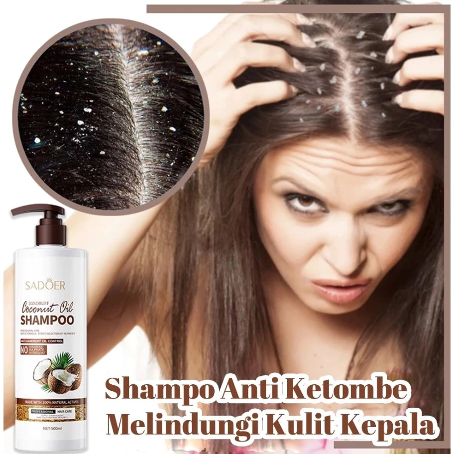 Jaminan Harga Anti-dandruff Coconut Oil shampoo kelemumur ubat Oil Control Relieve Scalp Itchy