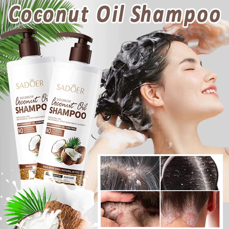 Jaminan Harga Anti-dandruff Coconut Oil shampoo kelemumur ubat Oil Control Relieve Scalp Itchy