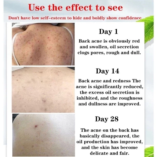 Wormwood Anti-Acne body wash Anti Bacterial Wash Shower Gel Body Wash Relieve itching Lasting Deep Clean 500ML