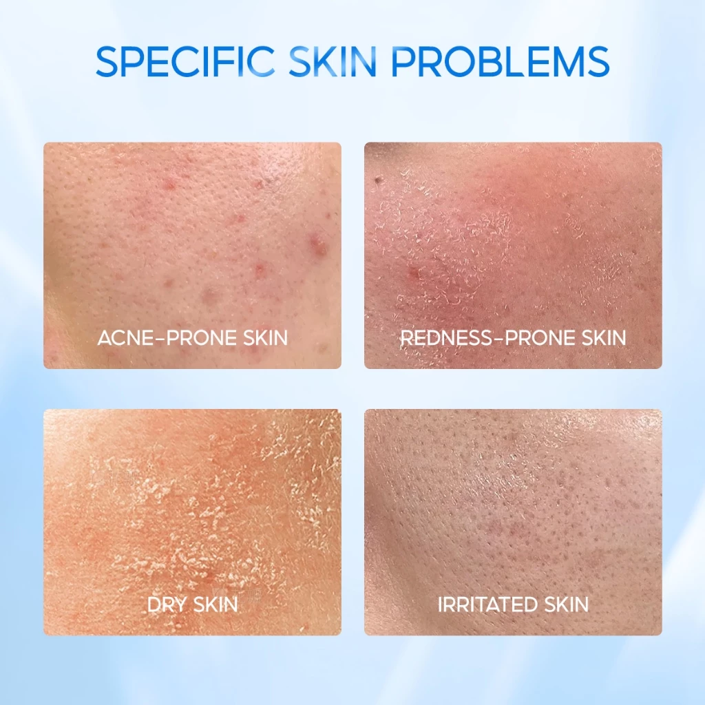 ELFORMULA Intensive CeraHydro Moisturizer Gel Skin Barrier Repair Moisturiser Skincare for Face with Ceramide 50ML