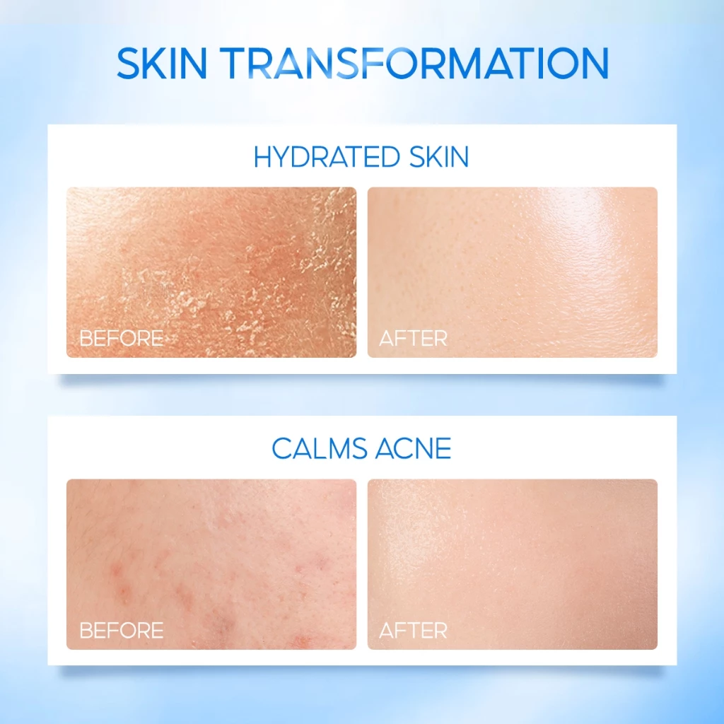 ELFORMULA Intensive CeraHydro Moisturizer Gel Skin Barrier Repair Moisturiser Skincare for Face with Ceramide 50ML