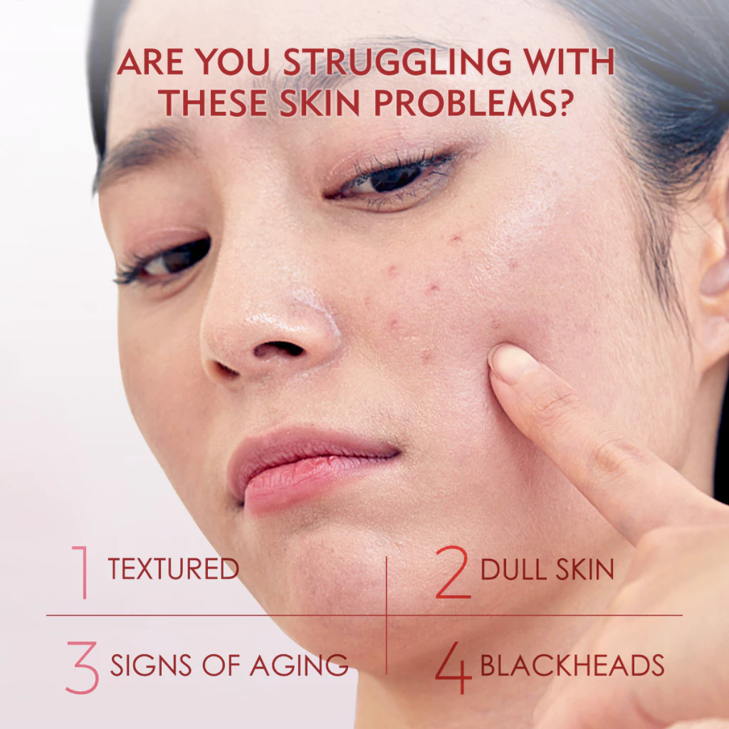 ELFORMULA Intensive Peeling Solution AHA BHA PHA Peeling Serum Exfoliating Dark Spot Whitening Brightening Treatment 35g