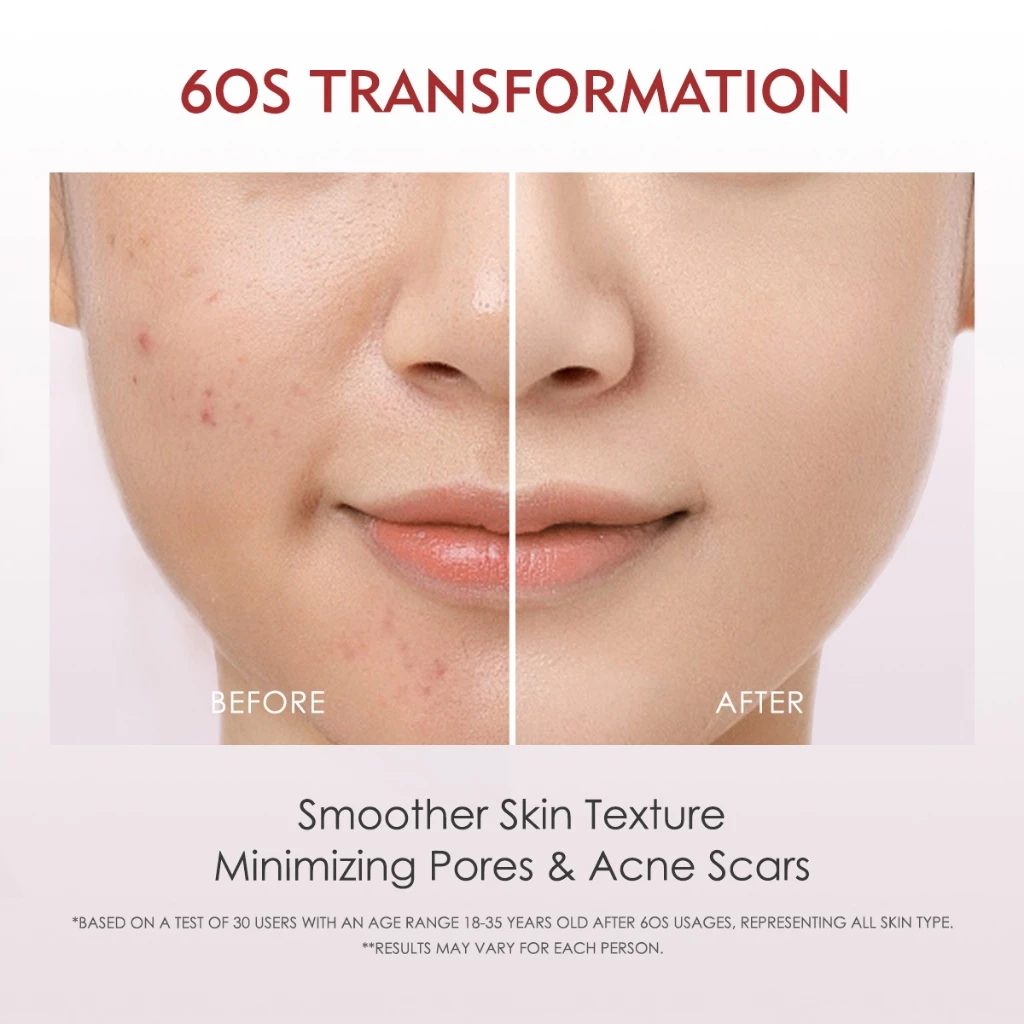 ELFORMULA Intensive Peeling Solution AHA BHA PHA Peeling Serum Exfoliating Dark Spot Whitening Brightening Treatment 35g