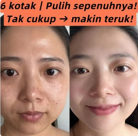 Avocado Bubble Mask – Pembersihan Mendalam, Melembapkan Kulit, Pengelupasan Lembut, Mencerahkan