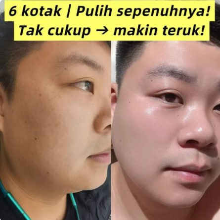 Avocado Bubble Mask – Pembersihan Mendalam, Melembapkan Kulit, Pengelupasan Lembut, Mencerahkan