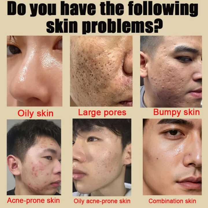 Pencuci Muka, oil control and acne treatment, deep cleansing, removes oil and blackheads, anti-mite, refreshing and gentle, moisturizing, suitable for all skin types, brightens skin tone, 150ml